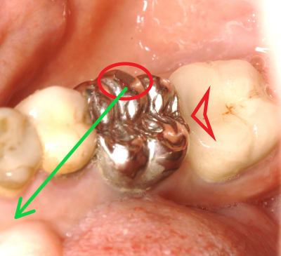 4 veelre - Eugenol