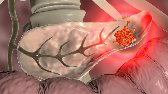 shutterstock_1605172135-min