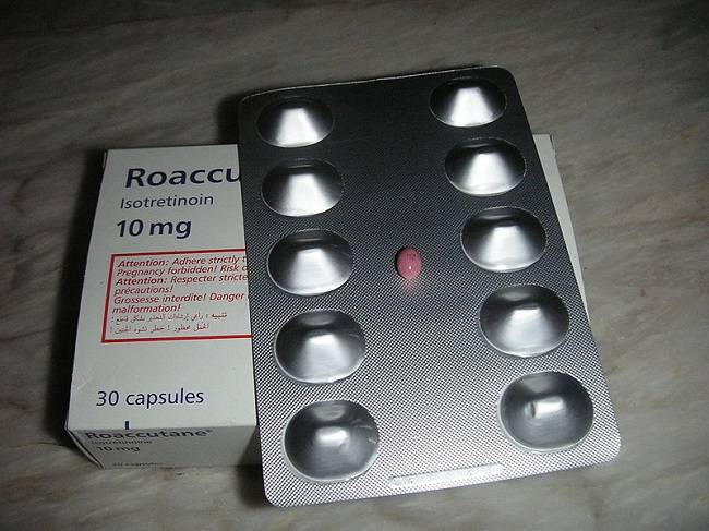 Sumber: AT Lima, jpogi, Wikimedia commons, 2010.