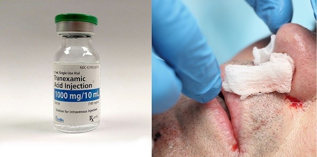 Sumber: Mark Oniffrey, Wikimedia commons, 2017. (untuk gambar asam traneksamat)