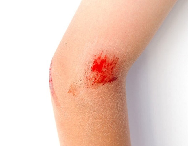 Depositphotos_30932687_m-2015_compressed