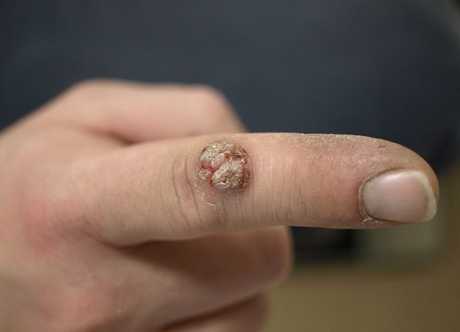 Sumber: Peter DK, Wikimedia commons, 2008.