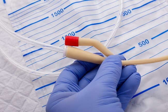 Penggunaan Kateter Uretra Pasca Operasi Histerektomi Radikal (2)-min