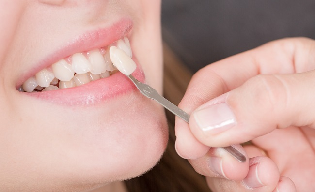 Check,Color,Of,New,Tooth,Crown