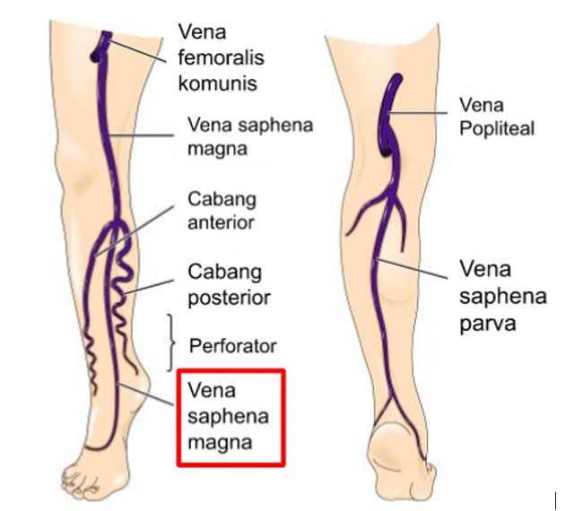 gambar 1 Vena Seksi-min