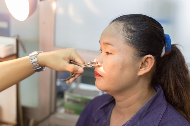 pemeriksaan fisik hidung, pemeriksaan hidung, rhinoskopi, rhinoskopi anterior, rinoskopi anterior, rinoskopi, alomedika