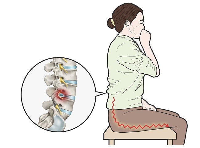 Manuver Valsalva-min