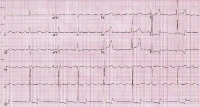 Sumber: Openi, 2009.