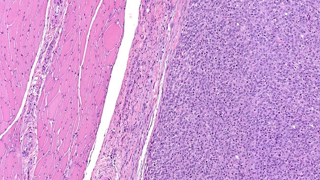 shutterstock_78033154-min