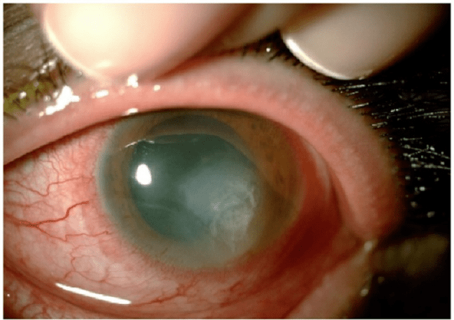 Sumber: Openi, 2014.