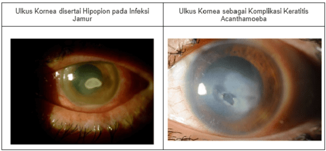 Sumber: Openi, 2014 dan Openi, 2015.
