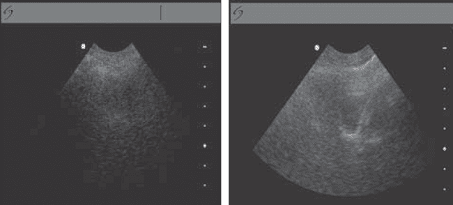 Sumber: Price D, et al., 2003.