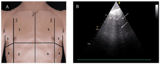 Sumber: Glöckner et al., 2020.