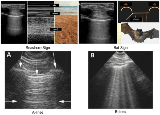 Sumber: Milena Pandrc, Andjelka Ristic-Andjelkov, et al., 2015 dan Stéphane Bar, et al., 2022.