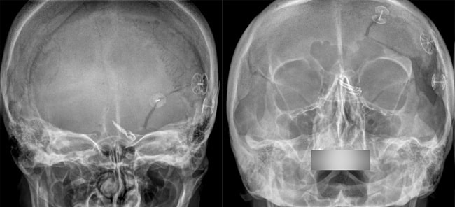 Sumber: Wikimedia Commons, 2023.