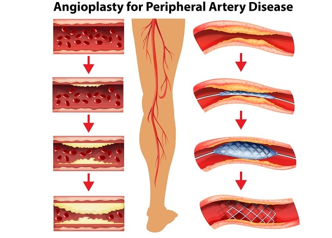 ilustrasiperbandingan