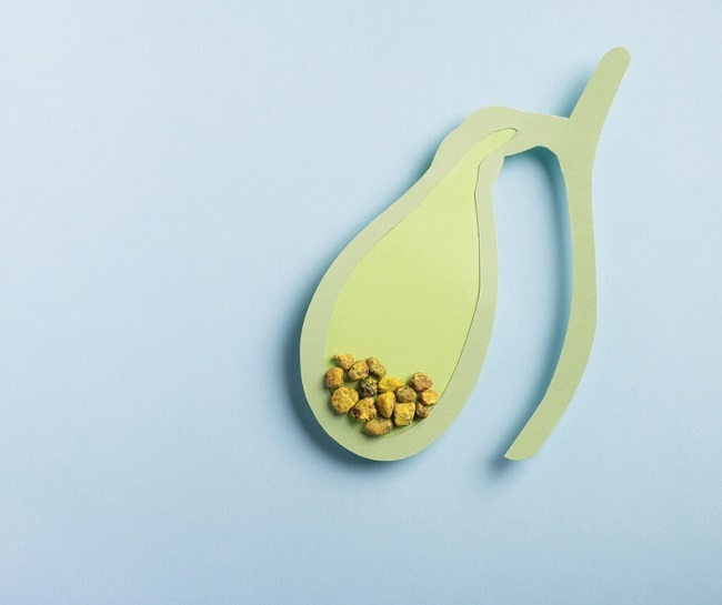 Gallbladder,Decorative,Model,With,Gallstones,On,Pastel,Blue,Background.,Gallbladder