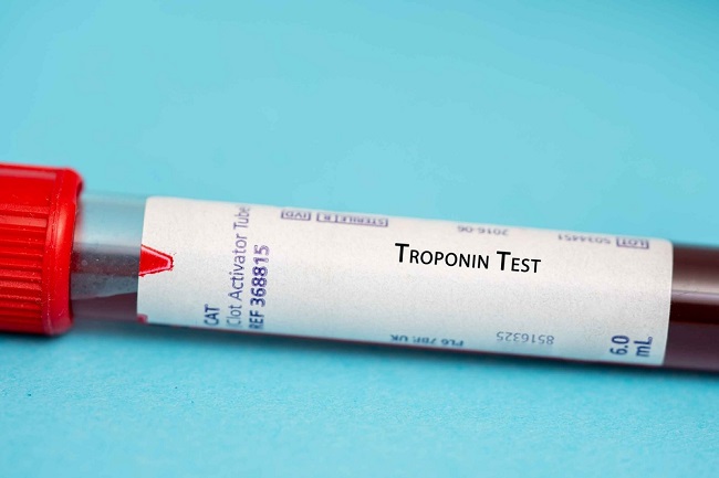 Troponin,Test,This,Test,Measures,The,Levels,Of,Troponin,,A