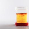 Red Flag Hematuria