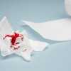 Red Flag Postcoital Bleeding