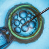 Perbedaan IVF dan IUI