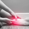 Injeksi Kortikosteroid pada Plantar Fasciitis