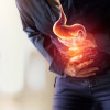 Irritable Bowel Syndrome dan Small Intestinal Bacterial Overgrowth: Serupa Tapi Tak Sama
