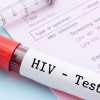 Rekomendasi Pemeriksaan HIV Menurut WHO