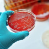 Mengatasi Resistensi Antibiotik terhadap Gonorrhea