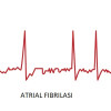 Hubungan Pemberian Kalium dan Magnesium Intravena dengan Konversi Atrial Fibrilasi