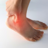 Manfaat USG pada Tarsal Tunnel Syndrome