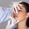 Rhinoplasty Non-Bedah
