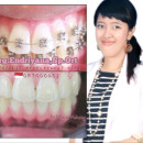 drg.Endriyana Novitasari,Sp.Ort