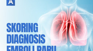 Video Alomedika - Sistem Skoring untuk Diagnosis Emboli Paru