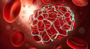 Koagulopati pada COVID-19