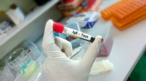 Serum Specific IgE sebagai Pemeriksaan Alergi