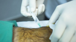 Platelet-Rich Plasma (PRP) Intra-artikular untuk Pengobatan Osteoartritis