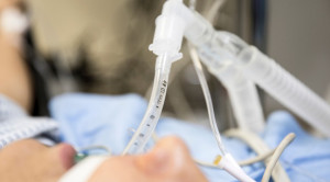 Intubasi dan Ventilasi pada Pasien ARDS dengan COVID-19