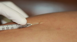 Antibiotic Skin Test Bukan Prediktor yang Tepat untuk Reaksi Alergi