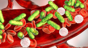 Pedoman Sepsis dan Syok Sepsis pada Anak Terbaru