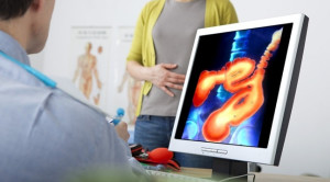 Skrining Kanker Kolorektal: Kapan dan Bagaimana?