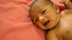 Red Flag Ikterus Neonatorum