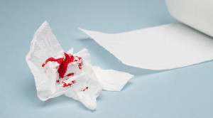 Red Flag Postcoital Bleeding