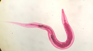 Enterobius vermicularis pada Kasus Appendicitis