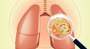 Efikasi dan Keamanan Lefamulin untuk Penatalaksanaan Pneumonia Komuniti - Telaah Jurnal