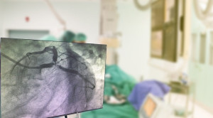 Monoterapi Ticagrelor untuk Pasien Berisiko Tinggi Perdarahan yang Menjalani Percutaneous Coronary Intervention – Telaah Jurnal Alomedika