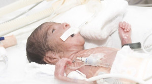 Pedoman Asupan Nutrisi bagi Bayi Prematur