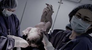 Kelahiran Per Vaginam Pasca Operasi Caesar (Vaginal Birth After Caesarean Section)