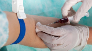 Bahaya Pemeriksaan Laboratorium Darah Rutin Sebelum Tindakan Bedah Elektif Nonkardiak