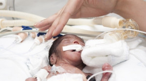 Menilai Pertumbuhan Bayi Prematur